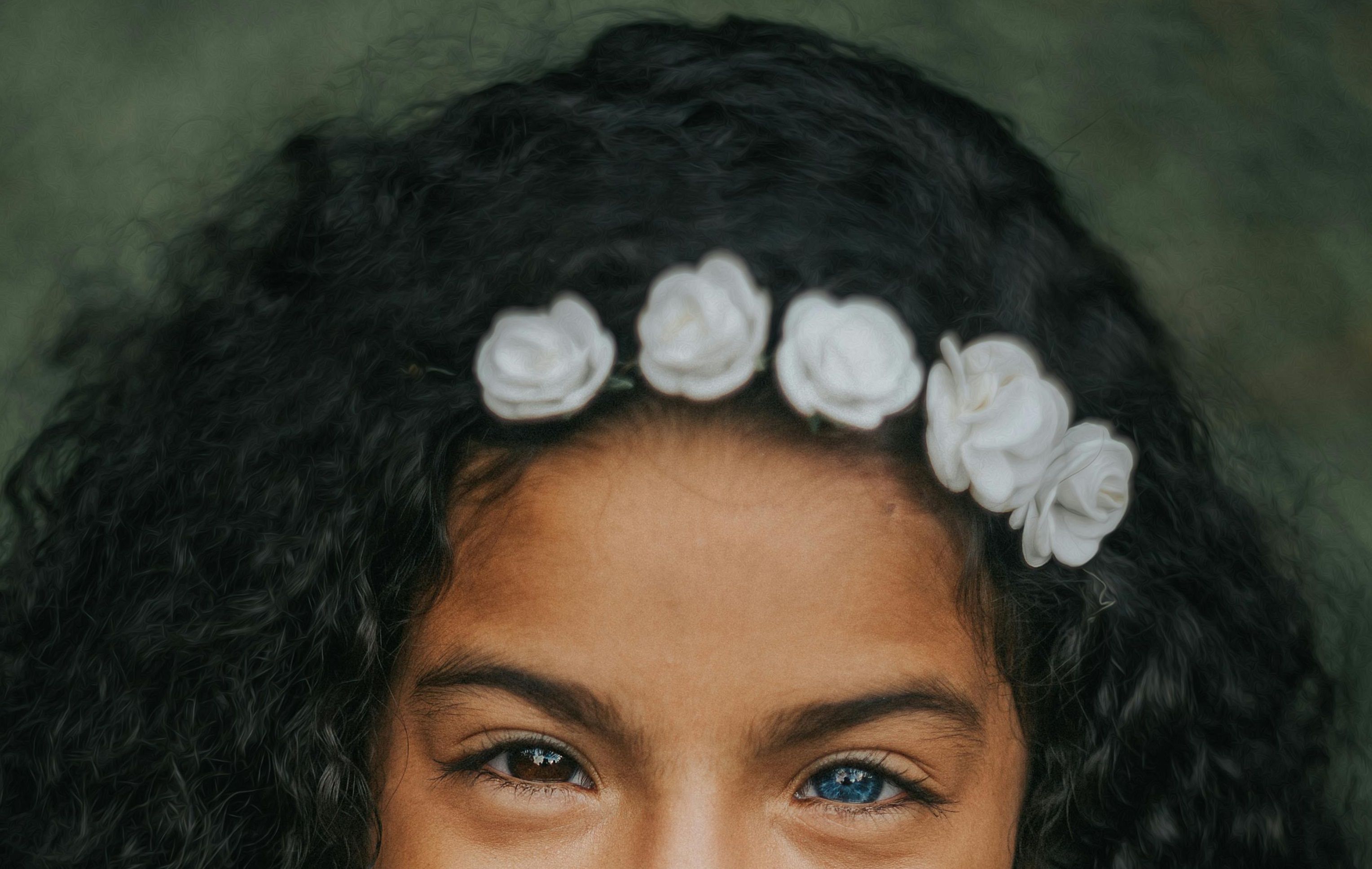 Heterocromia é raro. | Foto: Ilustrativa/Pexels