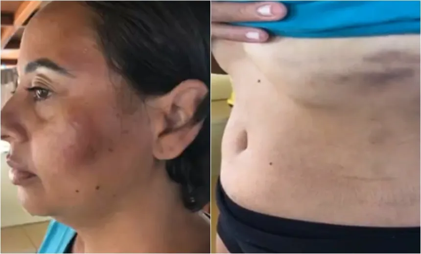 Velejadora capixaba é agredida e roubada por piratas na Bahia