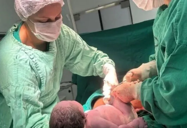 Bebê nasceu com 6 kg em um parto realizado por cesariana. Foto: Divulgação/Hospital Nossa Senhora Auxiliadora