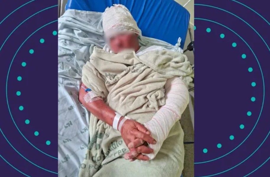 Homem Em Situa&ccedil;&atilde;o De Rua Agredido. | Foto: Reprodu&ccedil;&atilde;o Rede Social 